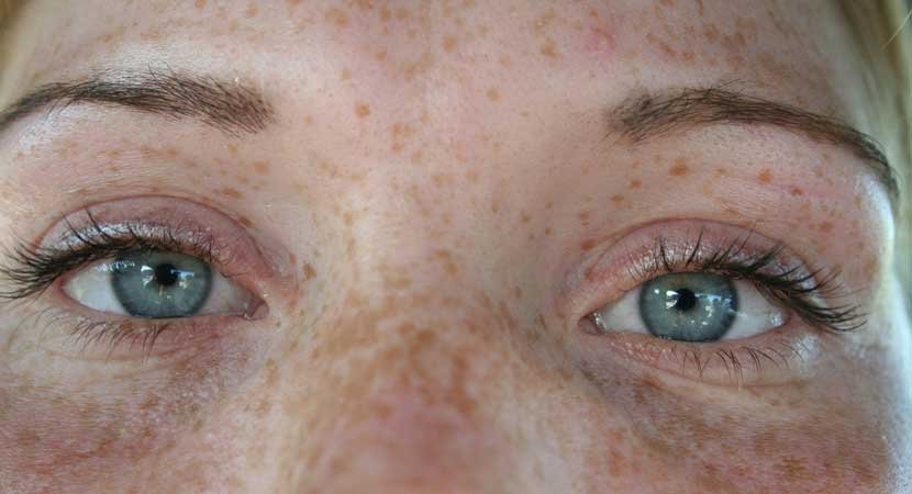 Dermatologists in Investigators